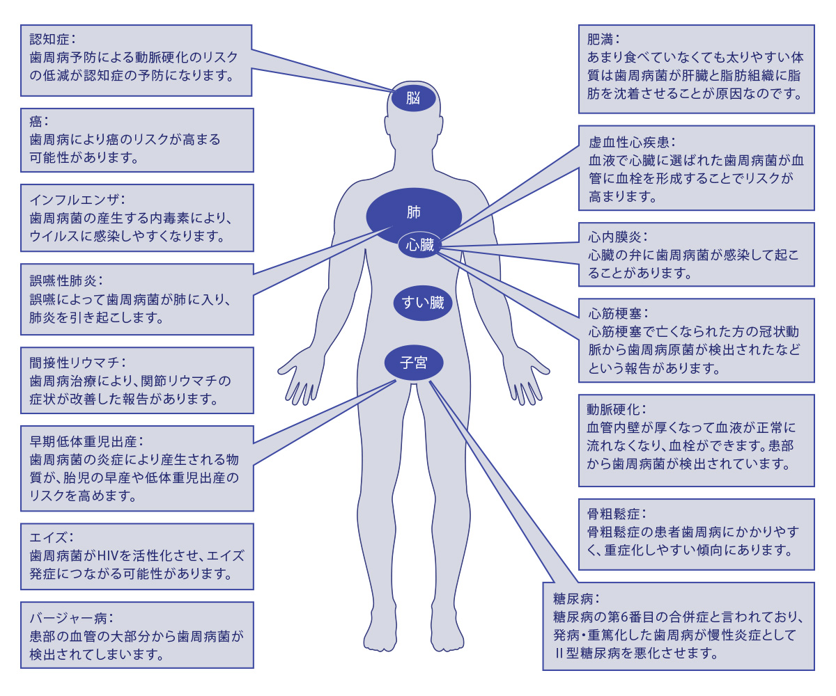 歯周病と全身疾患の関係