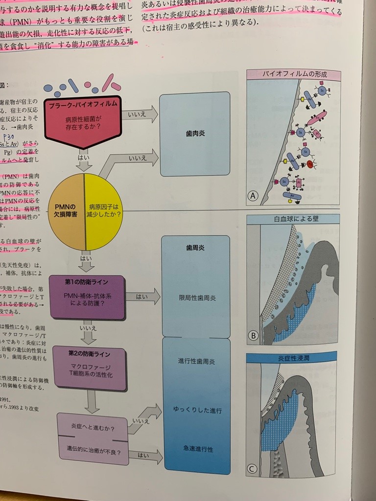 歯周病発病のメカニズム